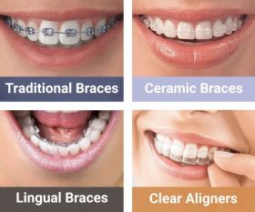 Root canal, extractions, fillings, restoration,etc