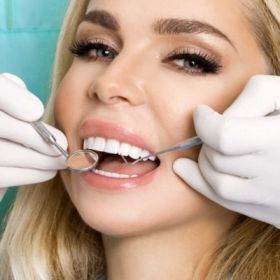 Composite Veneers in Dubai