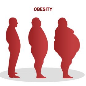 Obesity hospital in coimbatore - vgmgastrocentre
