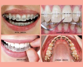 Orthodontics