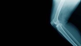 X-Ray Imaging Services in Navi Mumbai