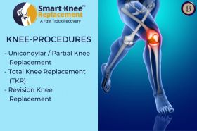 Knee Procedures in Chennai