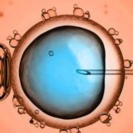 IVF Treatment