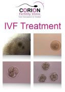 IVF Treatment in Mumbai