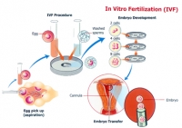 top ivf centers in hyderabad