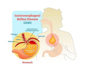 Best gerd specialist