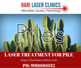 Laser Treatment for Piles