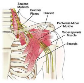 Shoulder Pain Treatment in Brooklyn NYC