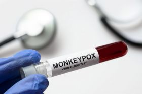 Monkeypox Testing and Treatment 