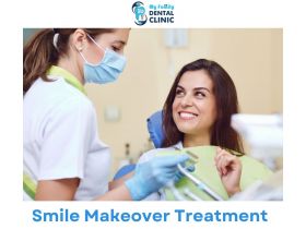 Smile Makeover Treatment