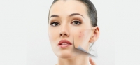 Doctors for pigmentation in Pune