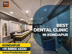 FMS Dental Clinic - Best Dental Clinic in Kondapur
