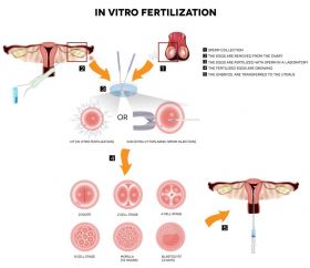 Best IVF  Centre in India