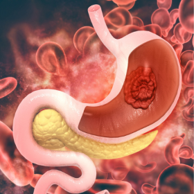 Ayurvedic Gastroenterologist Ahmedabad