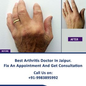 Arthritis