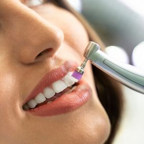 Teeth Polishing and Scaling in Dubai