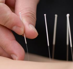  Diploma in Acupuncture Therapy  Level-I