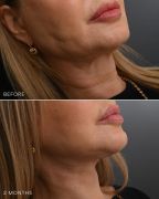 Artiste Plastic Surgery