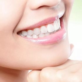 Teeth Whitening Cost in Dubai