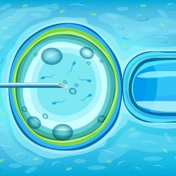 IVF In Vitro Fertilization