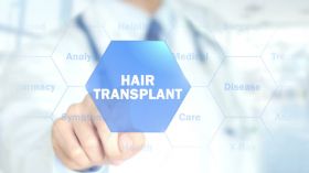 Hair transplant in Chandigarh