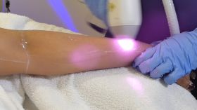 Laser Skin and Hair Care