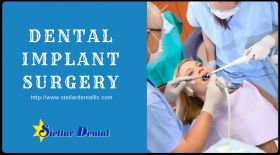 Dental Implant