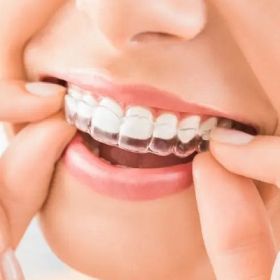 Dental Appliances in Dubai