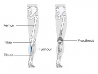 Orthopedic Surgery