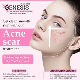  Acne Treatment in Indore | Genesis Cosmetology & 