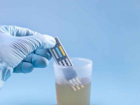 Drug Testing
