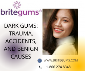 NATURALLY DARKER AND BLACK GUMS-