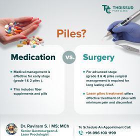 Laser Treatment for Piles