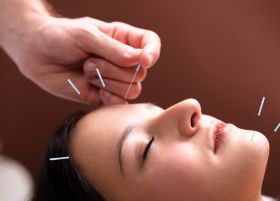 Acupuncture For Fatigue And Depression