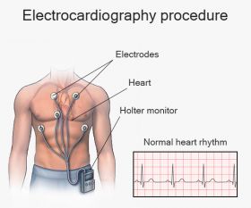 Electrocardiogram (EKG or ECG) in NYC