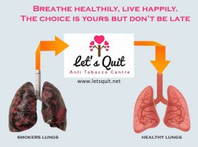 LetsQuit | Easy way to Quit Smoking Homeopathy way