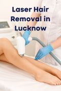 Laser Hair Removal in Lucknow
