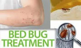 Bed Bug Control