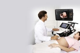 3D/4D SONOGRAPHY