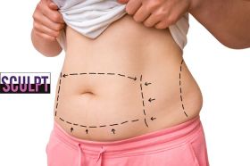 Tummy Tuck Surgery