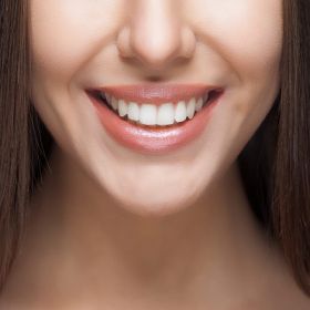 Gingivectomy in Dubai