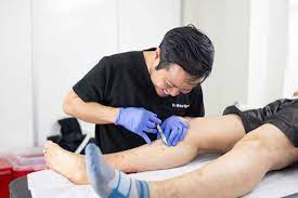 Texas Varicose Vein Treatment Near Me