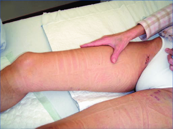 New Jersey Vein Treatment Center Near Me