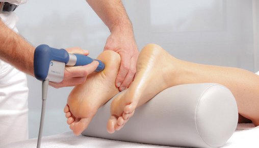 Shockwave Therapy Treatment in Toronto By Experts