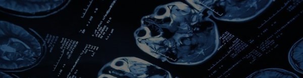 Stereotactic Vacuum Assisted Breast Biopsy for Accuracy - Picture This Imaging