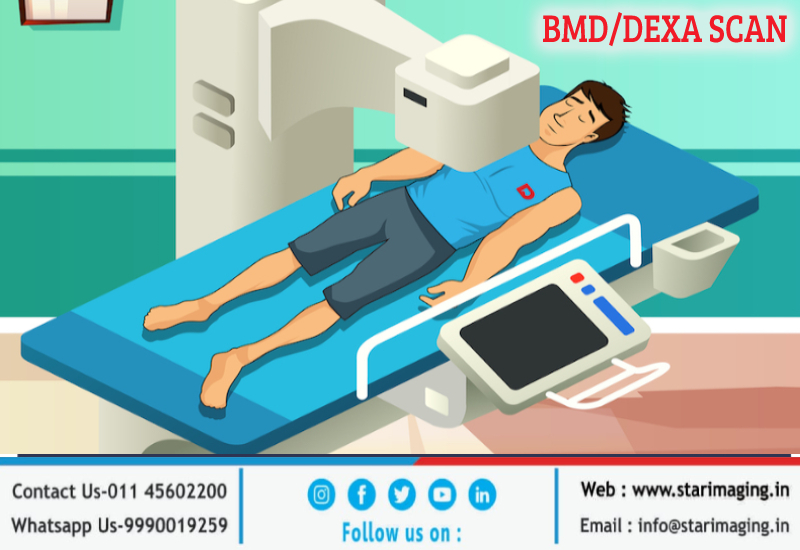 DEXA Scan Cost Near Me in Delhi NCR - Star Imaging & Path Lab
