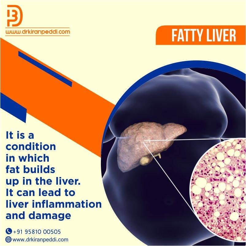 Liver Problems Treatment in Hyderabad | Dr. Kiran Peddi