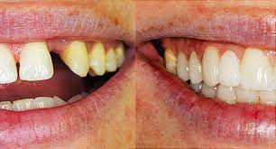 Best Restorative Dentistry Near Me