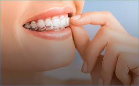 Root Canal Specialist - Houston, TX