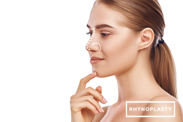Rhinoplasty in Islamabad